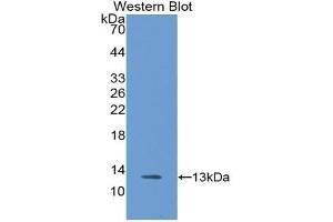Western blot analysis of the recombinant protein.