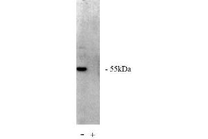 Image no. 1 for anti-Protein Phosphatase 2, Regulatory Subunit A, beta (PPP2R1B) antibody (ABIN264940)