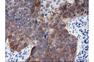 Immunohistochemical staining of paraffin-embedded Human pancreas tissue using anti-ALDH1L1 mouse monoclonal antibody. (ALDH1L1 Antikörper)
