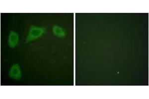 Immunofluorescence analysis of HuvEc cells, using Caveolin-1 Antibody. (Caveolin-1 Antikörper  (AA 129-178))