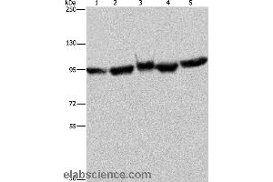 Western blot analysis of A549 and 293T cell, mouse brain tissue, K562 and Hela cell, using HSP90AA1 Polyclonal Antibody at dilution of 1:350 (HSP90AA2 Antikörper)