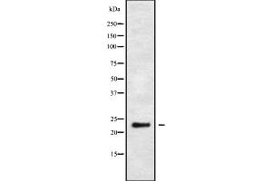 Western blot analysis of MRP-L48 using HuvEc whole cell lysates