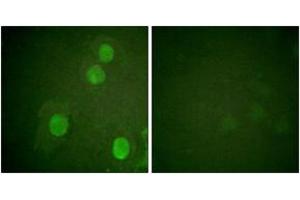 Immunofluorescence analysis of HuvEc cells, using Histone H4 (Phospho-Ser47) Antibody. (Histone H4 Antikörper  (pSer47))