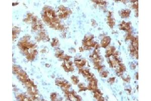 Formalin-fixed, paraffin-embedded rat stomach stained with TNF alpha antibody. (TNF alpha Antikörper)