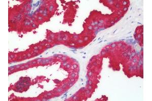 Anti-CD75 / ST6GAL1 antibody IHC staining of human prostate.