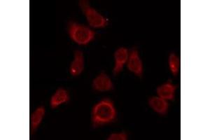 ABIN6275705 staining LOVO by IF/ICC. (ZP1 Antikörper  (Internal Region))