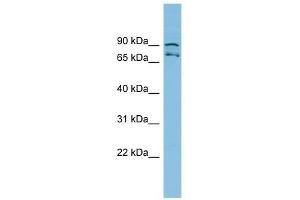 MTRR antibody used at 1 ug/ml to detect target protein.