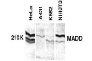 Western Blotting (WB) image for anti-MAP-Kinase Activating Death Domain (MADD) (C-Term) antibody (ABIN2475471)