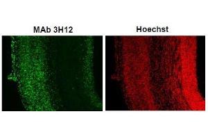 Immunofluorescence (IF) image for anti-Small Ubiquitin Related Modifier 2/3 (SUMO2/3) (full length) antibody (ABIN2452139) (SUMO2/3 Antikörper  (full length))