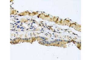 Immunohistochemistry of paraffin-embedded Mouse lung using ATP2C1 Polyclonal Antibody at dilution of 1:100 (40x lens). (ATP2C1 Antikörper)