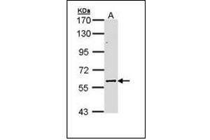Sample (30 ug of whole cell lysate). (ELP3/KAT9 Antikörper)