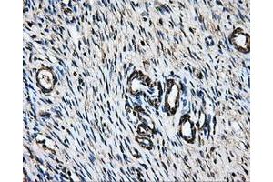 Immunohistochemical staining of paraffin-embedded liver tissue using anti-LOXmouse monoclonal antibody. (LOX Antikörper  (AA 22-168))