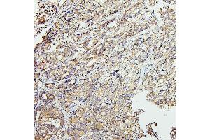 IHC analysis of CETP using anti-CETP antibody (ABIN7602439). (CETP Antikörper  (AA 77-353))