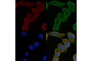 ABIN6259339 and ABIN6275439 staining Hela cells(30 min of UV treatment) by IF/ICC.