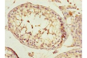 Immunohistochemistry of paraffin-embedded human testis tissue using ABIN7170585 at dilution of 1:100 (SPICE1 Antikörper  (AA 1-220))