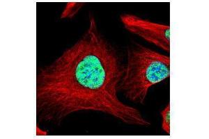 Immunofluorescence (IF) image for anti-Squamous Cell Carcinoma Antigen Recognized By T Cells (SART1) (Internal Region) antibody (ABIN2855616)