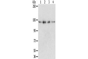 Western Blotting (WB) image for anti-RNA Binding Motif Protein 5 (RBM5) antibody (ABIN2424059)