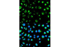 Immunofluorescence analysis of MCF7 cell using GYPC antibody. (CD236/GYPC Antikörper  (AA 1-128))