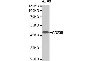 Western Blotting (WB) image for anti-CD209 (CD209) (AA 265-404) antibody (ABIN1679076) (DC-SIGN/CD209 Antikörper  (AA 265-404))
