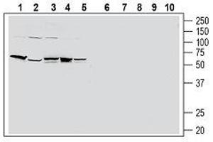 Western blot analysis of human HT-29 colon adenocarcinoma cell line lysate (lanes 1 and 6), human PANC-1 pancreatic carcinoma cell line lysate (lanes 2 and 7), human THP-1 monocytic leukemia cell line lysate (lanes 3 and 8), human Jurkat T-cell leukemia cell line lysate (lanes 4 and 9) and human MCF-7 breast adenocarcinoma cell line lysate (lanes 5 and 10): - 1-5. (F2RL1 Antikörper  (Extracellular, N-Term))