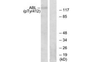 Western Blotting (WB) image for anti-C-Abl Oncogene 1, Non-Receptor tyrosine Kinase (ABL1) (pTyr393) antibody (ABIN2888351) (ABL1 Antikörper  (pTyr393))