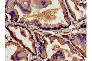 Immunohistochemistry of paraffin-embedded human prostate tissue using ABIN7172109 at dilution of 1:100 (Thymic Stromal Lymphopoietin Antikörper  (AA 29-159))