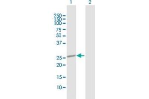 Western Blot analysis of OTUB2 expression in transfected 293T cell line by OTUB2 MaxPab polyclonal antibody. (OTUB2 Antikörper  (AA 1-234))