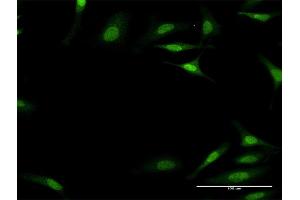 Immunofluorescence of monoclonal antibody to PLEC1 on HeLa cell. (PLEC Antikörper  (AA 4384-4493))