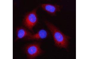 IF analysis of GSDMD using anti-GSDMD antibody (ABIN7599431). (GSDMD Antikörper  (AA 1-484))