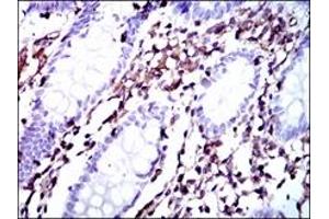 Immunohistochemistry (IHC) image for anti-Moesin (MSN) antibody (ABIN1108275) (Moesin Antikörper)