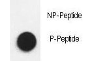Dot Blot (DB) image for anti-Nephrosis 1, Congenital, Finnish Type (Nephrin) (NPHS1) (pTyr1193) antibody (ABIN3031952)