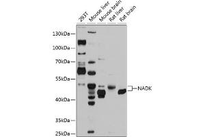 Western blot analysis of extracts of various cell lines, using NADK antibody (ABIN6128326, ABIN6144340, ABIN6144341 and ABIN6224894) at 1:1000 dilution. (NADK Antikörper  (AA 1-180))