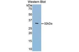 Western Blotting (WB) image for anti-Meningioma Expressed Antigen 5 (Hyaluronidase) (MGEA5) (AA 319-450) antibody (ABIN1859957) (MGEA5 Antikörper  (AA 319-450))