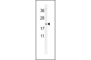 DMRTC1 Antibody (N-term) (ABIN654523 and ABIN2844245) western blot analysis in MDA-M cell line lysates (35 μg/lane). (DMRTC1 Antikörper  (N-Term))