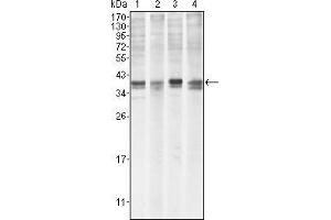 Western Blot showing MCL1 antibody used against Hela (1), BCBL-1 (2), Jurkat (3) and HL60 (4) cell lysate. (MCL-1 Antikörper)