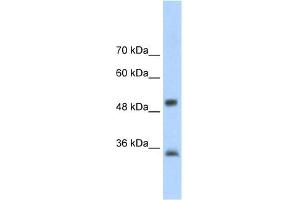 WB Suggested Anti-AIP Antibody Titration:  2. (AIP Antikörper  (N-Term))