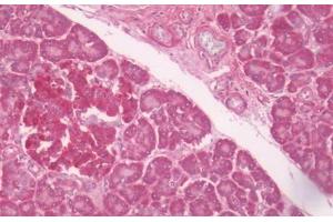 Human Pancreas: Formalin-Fixed, Paraffin-Embedded (FFPE) (LPAR6 Antikörper  (C-Term))