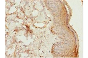 Immunohistochemistry of paraffin-embedded human skin tissue using ABIN7158391 at dilution of 1:100 (LHX6 Antikörper  (AA 114-363))