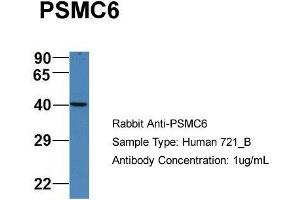Western Blotting (WB) image for anti-Proteasome (Prosome, Macropain) 26S Subunit, ATPase, 6 (PSMC6) (C-Term) antibody (ABIN2788038)
