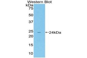 Detection of Recombinant LILRB4, Mouse using Polyclonal Antibody to Leukocyte Immunoglobulin Like Receptor Subfamily B, Member 4 (LILRB4) (LILRB4 Antikörper  (AA 24-206))