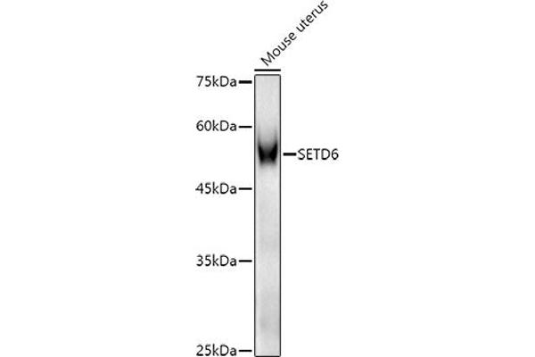 SETD6 Antikörper  (AA 301-473)