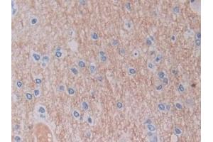 Immunohistochemistry (IHC) image for anti-serine Hydroxymethyltransferase 2 (Mitochondrial) (SHMT2) (AA 30-504) antibody (ABIN7443701)