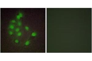 Immunofluorescence analysis of A549 cells, using HAND1 Antibody. (HAND1 Antikörper  (AA 141-190))