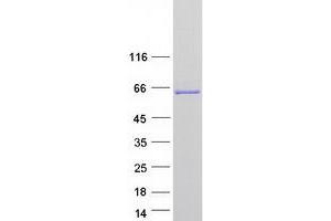 Western Blotting (WB) image for Myotubularin Related Protein 6 (MTMR6) protein (Myc-DYKDDDDK Tag) (ABIN2726537)