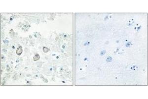 Immunohistochemistry (IHC) image for anti-Docking Protein 7 (DOK7) (AA 10-59) antibody (ABIN6766020)