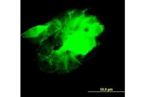 Image no. 4 for anti-CDC42 Binding Protein Kinase beta (DMPK-Like) (CDC42BPB) (AA 1580-1679) antibody (ABIN599085) (CDC42BPB Antikörper  (AA 1580-1679))