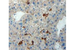 Used in DAB staining on fromalin fixed paraffin-embedded Liver tissue (TJP1 Antikörper  (AA 1-190))