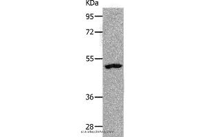 Western blot analysis of Human lymphoma tissue, using NDRG1 Polyclonal Antibody at dilution of 1:1000 (NDRG1 Antikörper)