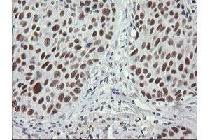 Image no. 8 for anti-SEC14 and Spectrin Domains 1 (SESTD1) antibody (ABIN1501066)