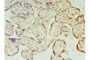 Immunohistochemistry of paraffin-embedded human placenta tissue using ABIN7163449 at dilution of 1:100 (PIH1D1 Antikörper  (AA 1-290))